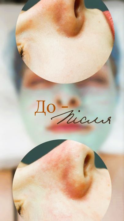 Чистка лиця (120 хв)
